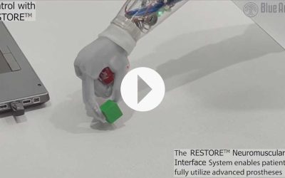 Blue Arbor Technologies Receives FDA Breakthrough Device Designation and TAP Enrollment for the RESTORE™ Neuromuscular Interface System